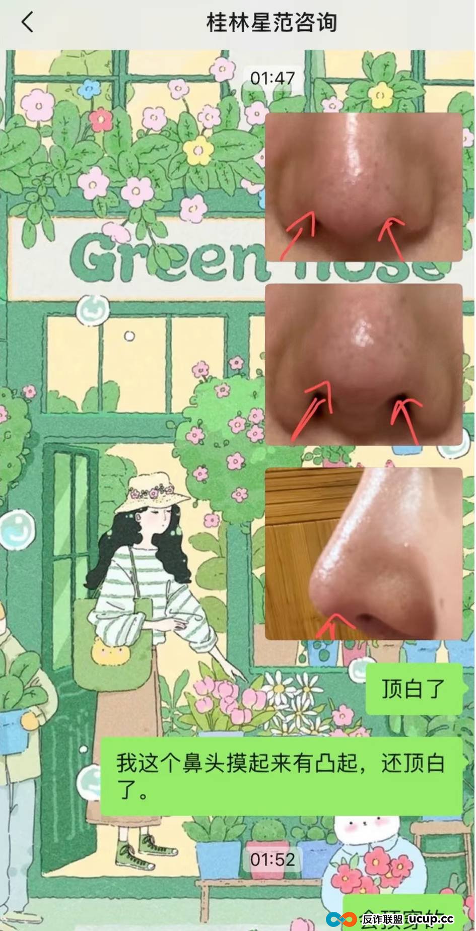 被曝用异体骨隆鼻之后，桂林星范整形如何重建消费者信任？(9)